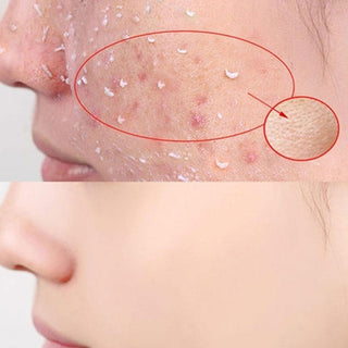 100ml Papaya Deep Cleansing Scrub Gel Dead Skin Removal Exfoliating Peeling Gel Face Body Moisturizing Whitening Skin Care Gel Alodia Store