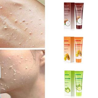 100ml Papaya Deep Cleansing Scrub Gel Dead Skin Removal Exfoliating Peeling Gel Face Body Moisturizing Whitening Skin Care Gel Alodia Store