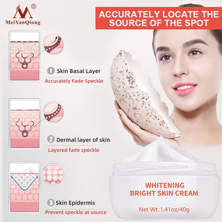 Dark Spot Remover Cream Skin Lightening Cream Dark Skin Care Anti Freckle  Whitening Cream  Anti Aging Face Care Alodia Store