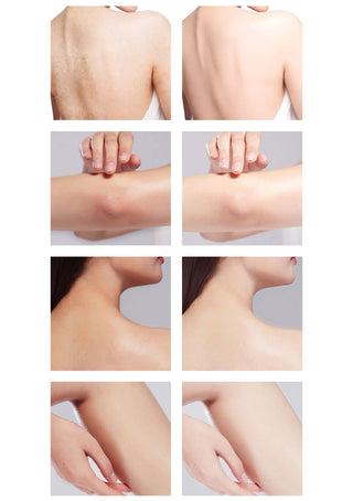 80g  Rapid Skin Bleaching Cream Soap Armpits Underarm /Groin Whitening Peach Scented Feminine Intimate Wash Body Scrub ALODIA STORE