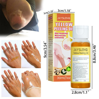 30ml Exfoliating Yellow Skin Oil Bleaching Dark Skin Removing Arms Knees Melanin Moisturizing Skin Whitening Beauty Skin Care ALODIA STORE