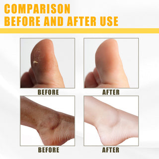 30ml Yellow Peeling Oil Lighten Dark Spots Acne Melanin Skin Bleaching Exfoliating Oil Whiten Brighten Skin For Face Body ALODIA STORE