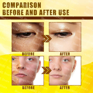 30ml Yellow Peeling Oil Strong Exfoliating Solution Bleaching Dark Skin Spots Blackheads for Body Face Skin Care Beauty ALODIA STORE