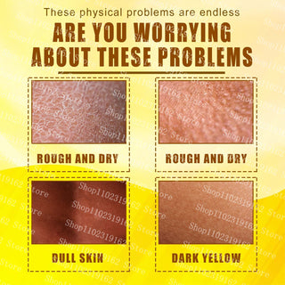 30ml Yellow Peeling Oil Strong Exfoliating Solution Bleaching Dark Skin Spots Blackheads for Body Face Skin Care Beauty ALODIA STORE