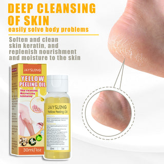 30ml Yellow Peeling Oil Lighten Dark Spots Acne Melanin Skin Bleaching Exfoliating Oil Whiten Brighten Skin For Face Body ALODIA STORE