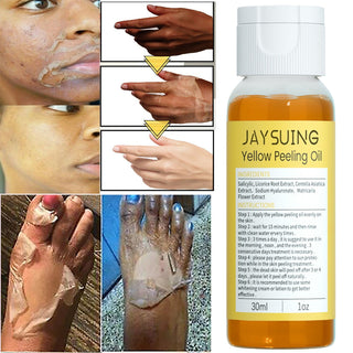 30ml Exfoliating Yellow Skin Oil Bleaching Dark Skin Removing Arms Knees Melanin Moisturizing Skin Whitening Beauty Skin Care ALODIA STORE