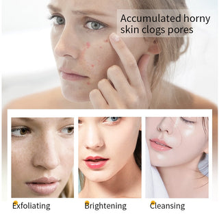 24K Gold Face Scrub Exfoliating Reduce Blackheads Peeling Gel Anti-Acne Pore Cleaning Body Skin Brighten Moisturizing Cream 200g ALODIA STORE