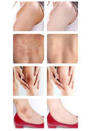 80g  Rapid Skin Bleaching Cream Soap Armpits Underarm /Groin Whitening Peach Scented Feminine Intimate Wash Body Scrub ALODIA STORE