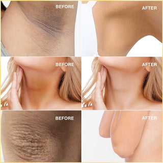 80g  Rapid Skin Bleaching Cream Soap Armpits Underarm /Groin Whitening Peach Scented Feminine Intimate Wash Body Scrub ALODIA STORE